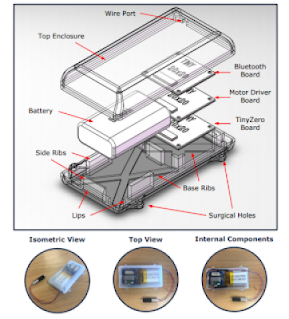 Internalization of a Nerve Lengthening Device