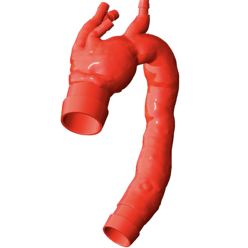 3D model of an aorta afflicted with a thoracic aortic aneurysm